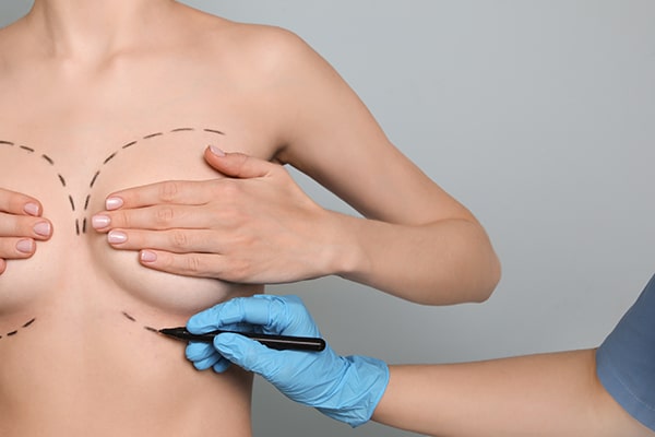 Meme Onarımı